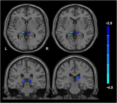 Frontiers Sex Differences In Re Experiencing Symptoms Between